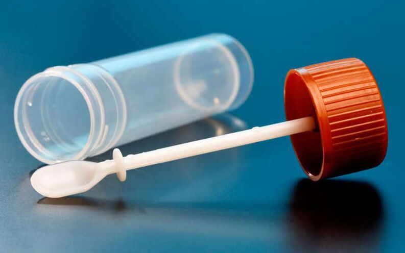 Δοκιμή κοπράνων για σκουλήκια