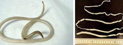 είδη παρασίτων στο ανθρώπινο σώμα