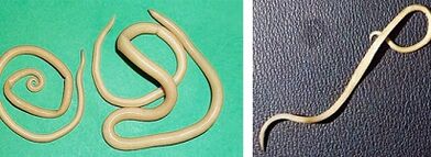 τι παράσιτα μπορεί να έχει ένας άνθρωπος;